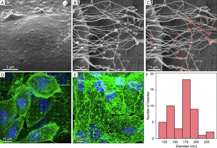 DeenaSierra1's tweet photo. Direct comparison of optical and electron microscopy methods for structural characterization of extracellular vesicles
#Cryoscanningelectronmicroscopy #Cryotransmissionelectron #structuralbiologyconferences #onlineevents #webinarevents #biochemistryconferences https://t.co/6UvkcTAywp