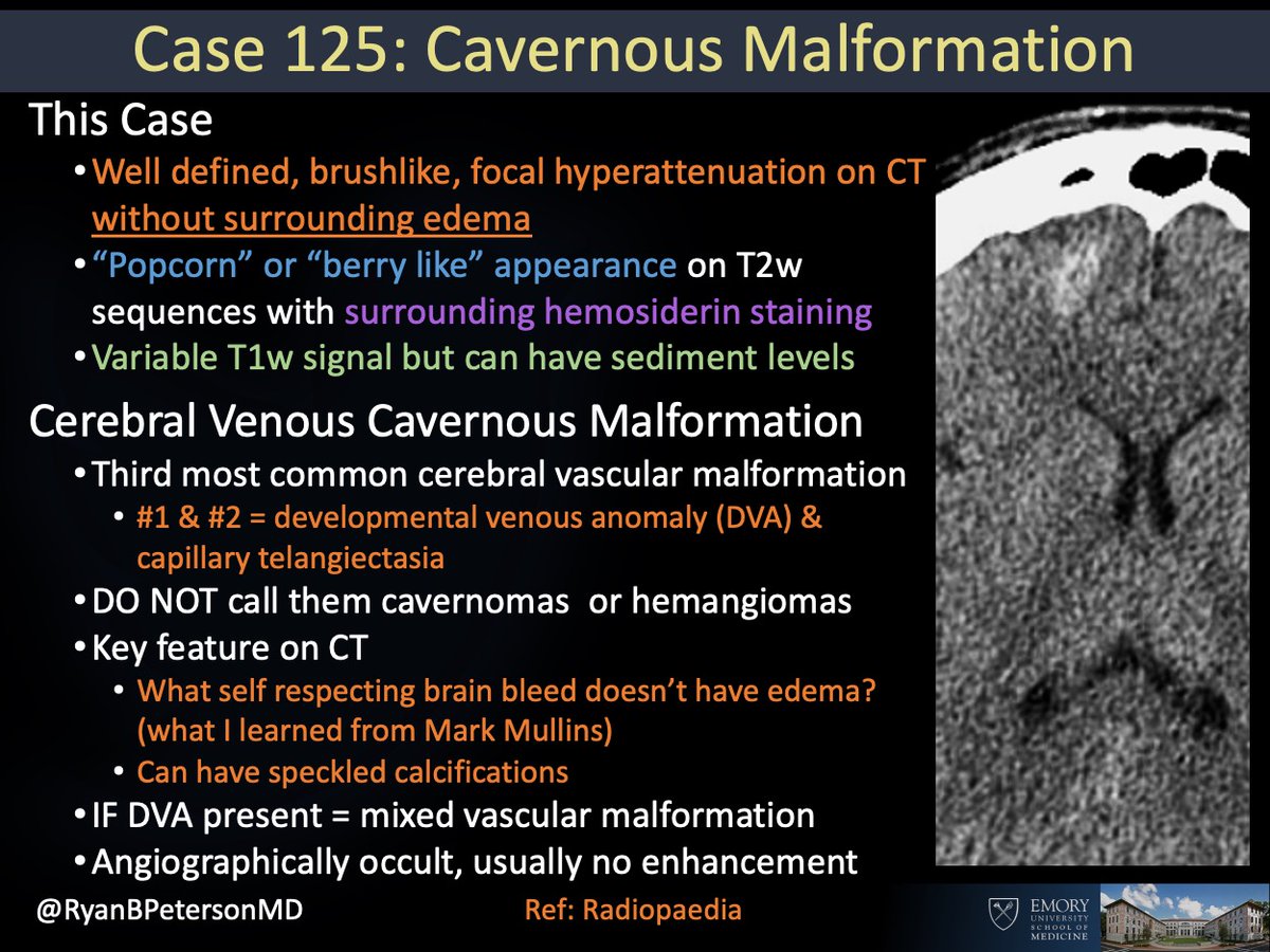 emory-radiology-cotd-125-hx-headaches-another-basic-case-necessary