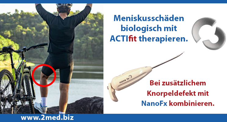 c_wesolowski's tweet photo. Operateure können Meniskusschäden biologisch mit #actifit versorgen. Bei parallelem Knorpeldefekt lässt sich die Therapie mit #nanofx kombinieren. https://t.co/7hmzMq21bU https://t.co/hN8DwXgC4t https://t.co/Jv6WtEpv2P https://t.co/YVl4Mc7ufX