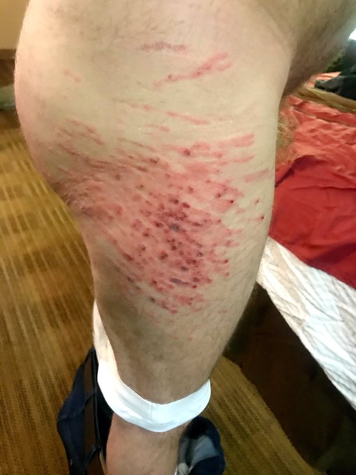 600 lashes with a switch. #MistressLydiaD #CorporalPunishment #Cane #TheTopFemDom #ImpactPlay #BDSM #Fetish<a href="/tag/mistresslydiad"class="tags">#MistressLydiaD</a><a href="/tag/corporalpunishment"class="tags">#CorporalPunishment</a><a href="/tag/bdsm"class="tags"><span>#bdsm</span></a><a href="/tag/fetish"class="tags"><span>#fetish</span></a><a href="/tag/cane"class="tags"><span>#cane</span></a><a href="/tag/adultcontent"class="tags"><span>#adultcontent</span></a><a href="/tag/impactplay"class="tags"><span>#impactplay</span></a>