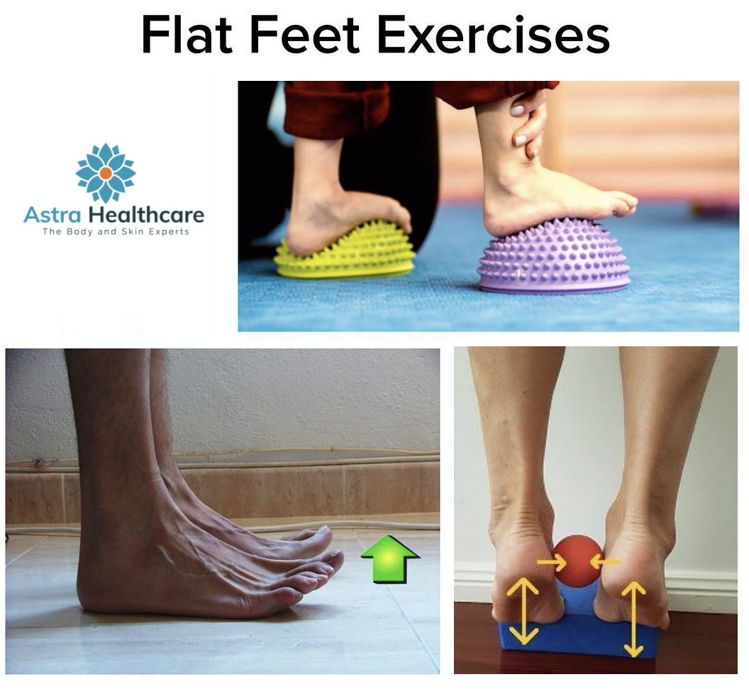 AstraHealthcare's tweet photo. 👉Flat feet are a common postural #deformity that affects millions of people. Are you looking to fix #flat feet? We got you! @AstraHealthcare our professional therapist takes care of your feet &amp; ankles for life!

Contact Astra Healthcare at 905-458-3400 

#orthotics #footcare https://t.co/ejZuFQI3Qx