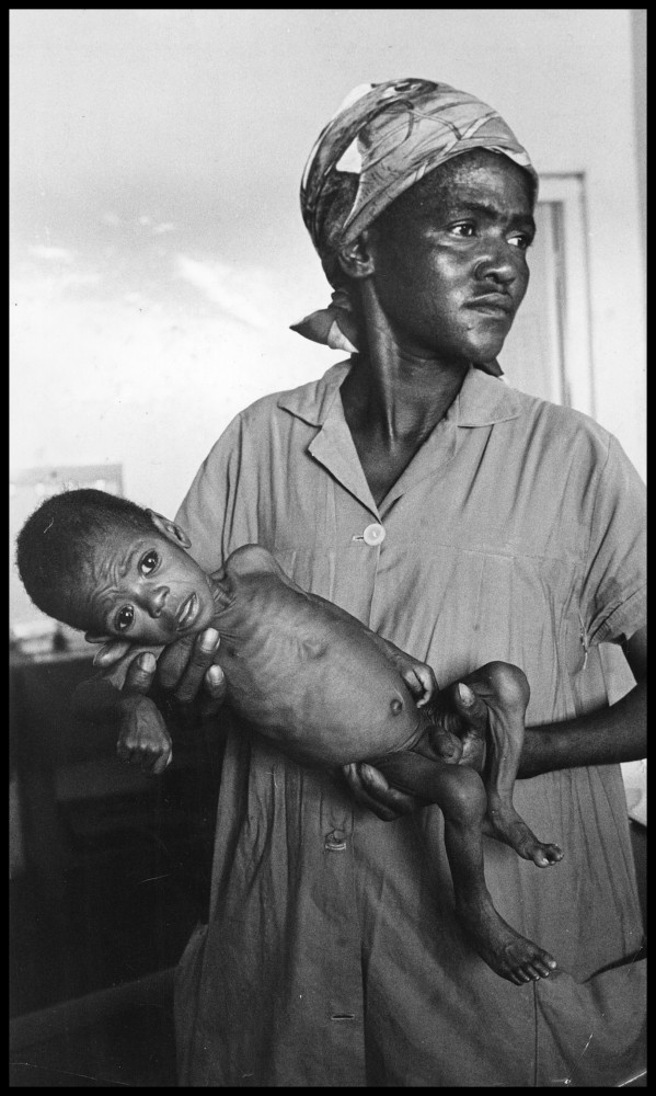 'One out of every four African babies die before their 1st birthday because their fathers earn starvation wages. Half of all black children die before 16. This four month old baby died of malnutrition two weeks after this picture was taken' - Handwritten note by Ernest Cole