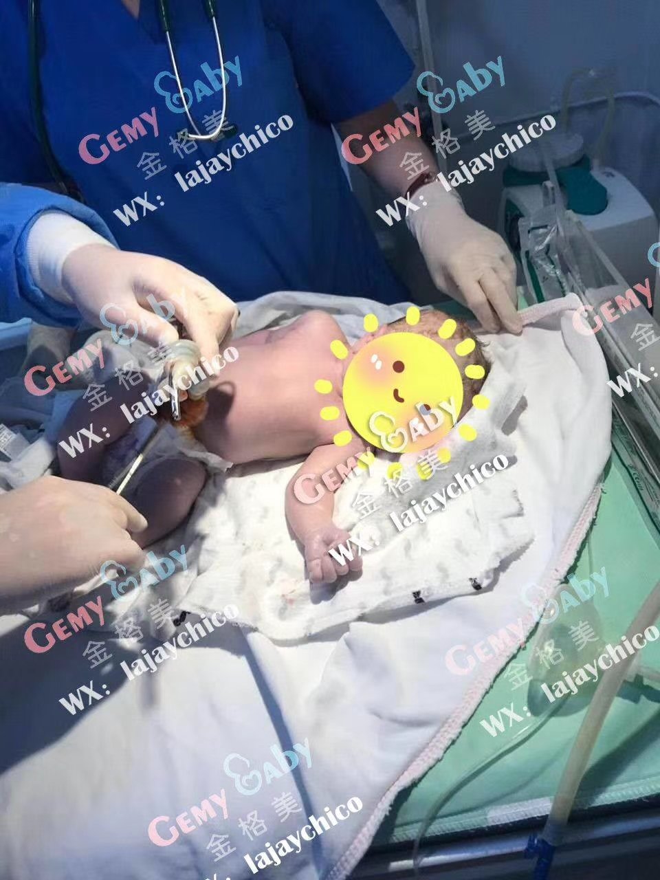 格美宝宝gemybaby 恭喜浙江的w先生 代妈41周 剖了一个大胖千金 8 4斤 格鲁吉亚少见 最最主要 宝宝非常健康漂亮 格鲁吉亚代孕