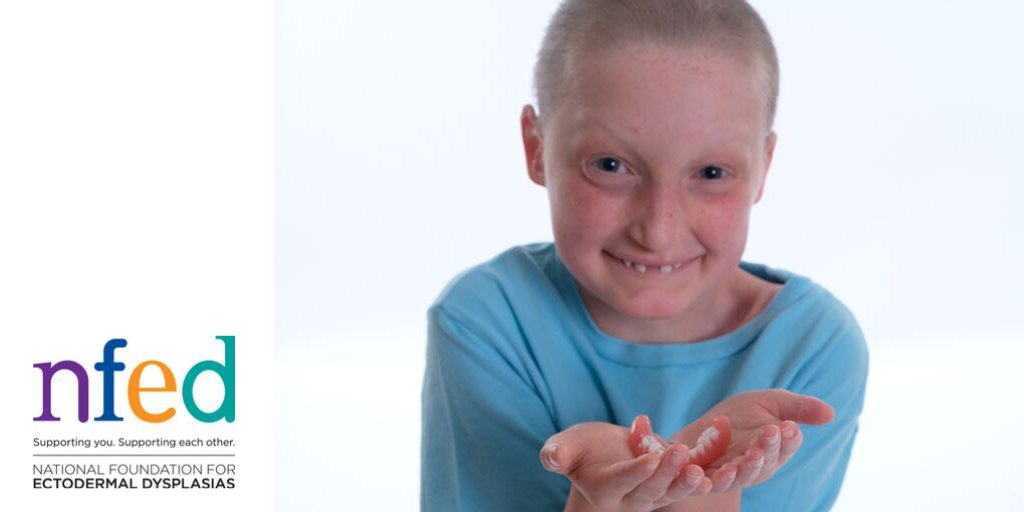 NFED_ORG's tweet image. People who lose or break their teeth have their dental treatment covered by insurance. The same cannot be said for individuals with ectodermal dysplasia who are born with missing teeth. Advocate for the #EnsuringLastingSmiles Act today. nfed.org/get-involved/a…