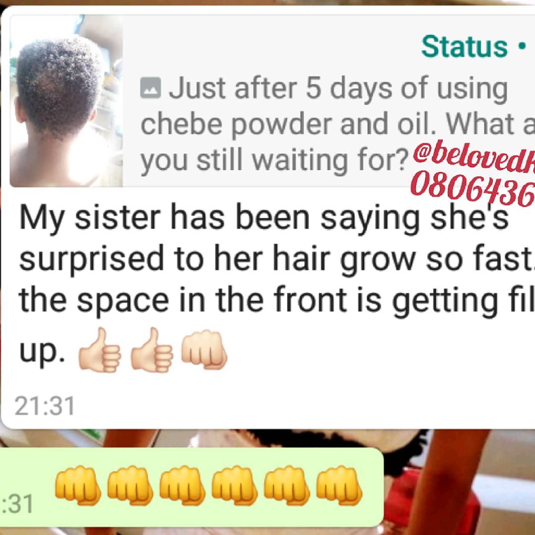 SijuadeVA's tweet photo. Our chebe product works wonder. I'm just a DM away from you.
#ChebePowder
#ChebeOil
#ChebeButter
#ChebeHairCream
#ChebeShampoo
#ChebeConditioner https://t.co/soVgH8KIAF