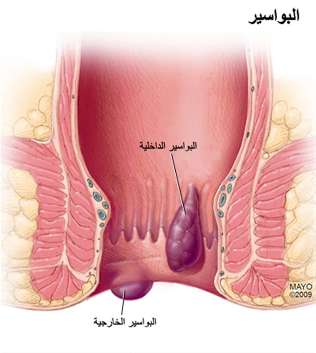 اسباب حكة فتحة الشرح