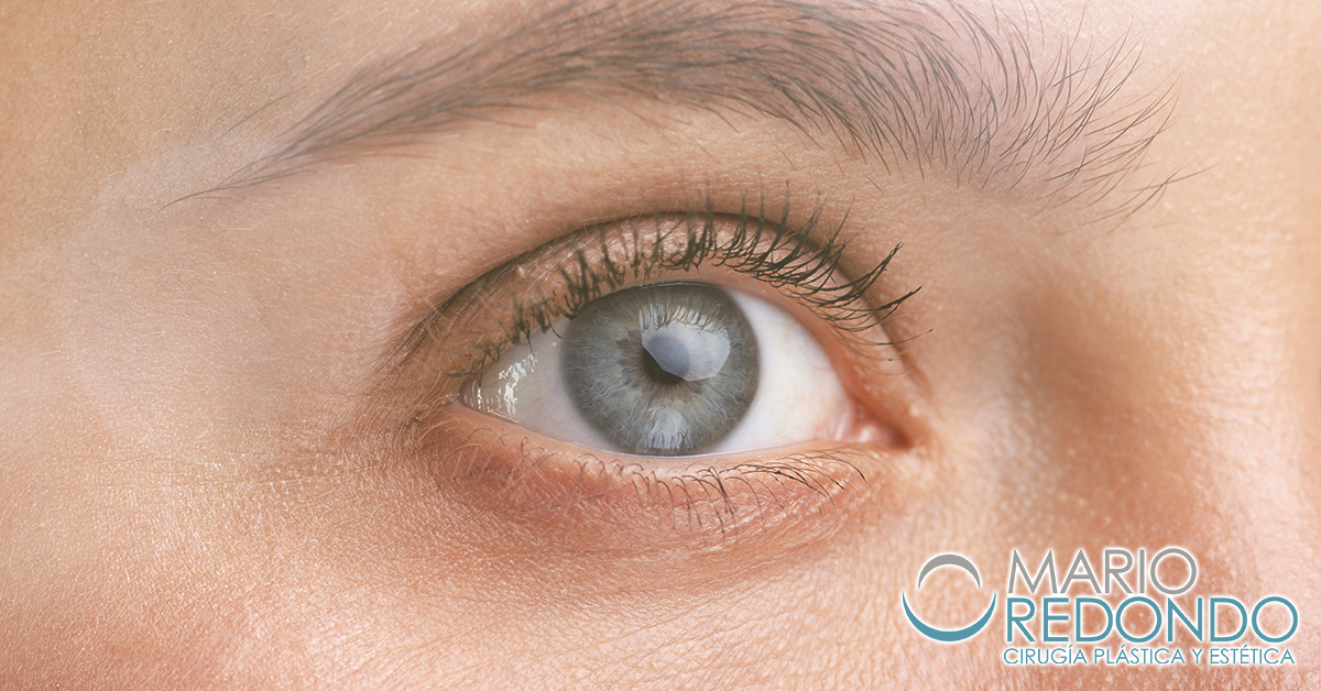 Los párpados con el paso de los años pueden acumular grasa o desarrollar exceso de músculo o piel. En Cirugía Plástica y Estética Mario Redondo, realizamos cirugía de párpados. Vuelve a lucir tu mirada

marioredondo.com/cirugia/cirugi…

#Párpados #Relleno #Blefaroplastia #Mirada #Cirugía