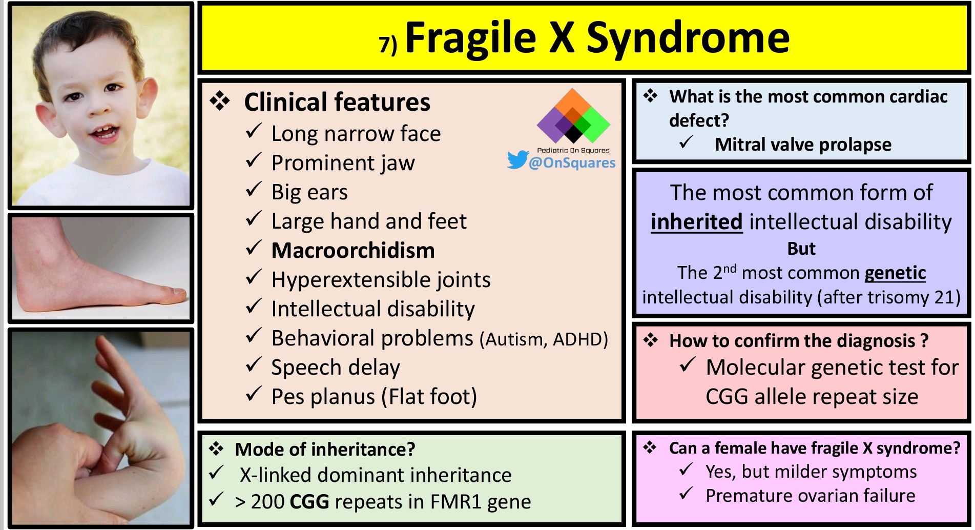 Pediatric On Squares On Twitter Fragile X Syndrome N N Pediatric