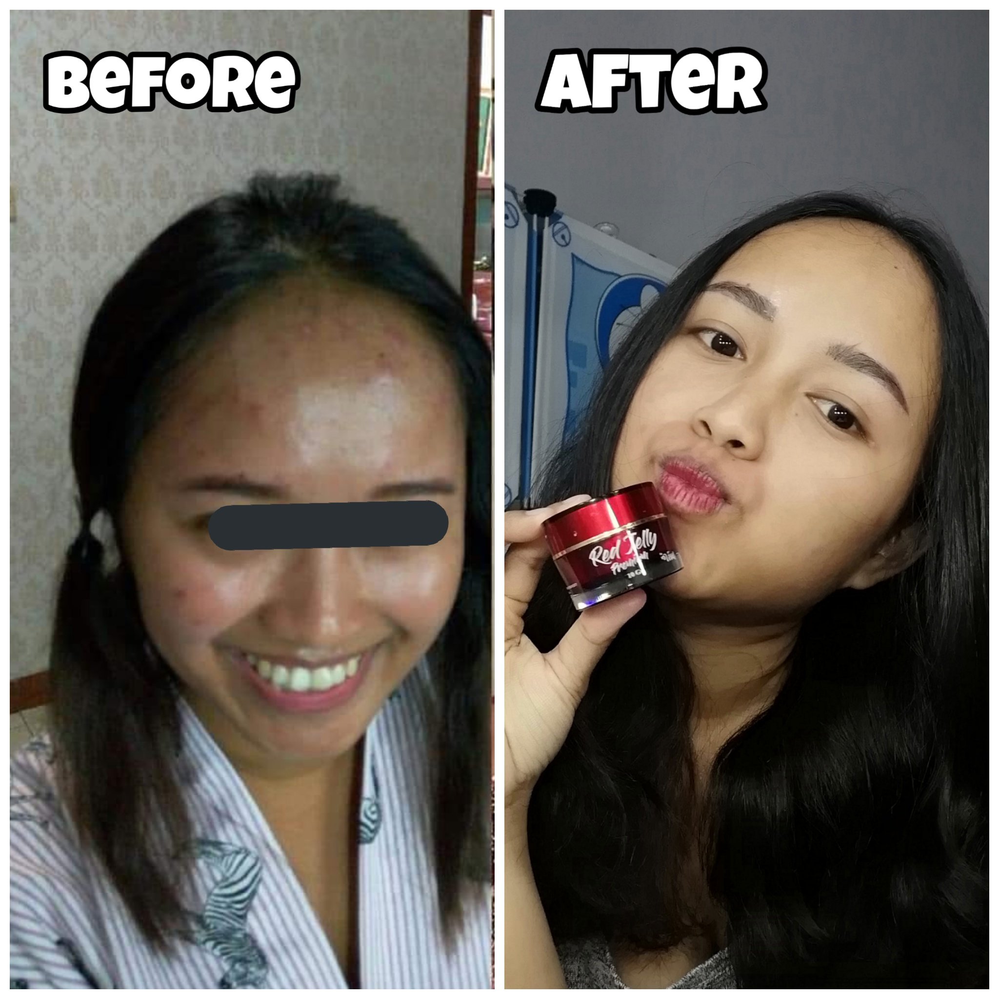 SkincareIDN Beauty Base on Twitter "/biu/ pengalaman pribadi aku pake