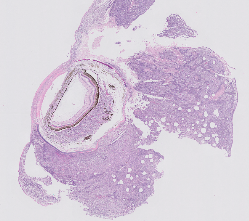 Flagship_VP's tweet photo. A soft tissue sarcoma in the head of a Woundfin that is invading into the eye through the sclera.  It died from a secondary bacterial sepsis. #vetpath #veterinary #pathology #fishpath https://t.co/vyqsKqBdEq