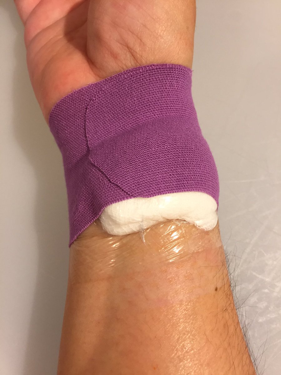 14. Gah - noticed one of my pressure dressings was peeling off.  called hospital and fellow said that as long as it’s not bleeding I can just tape it. Used kinesiotapeand it’s secure again. 