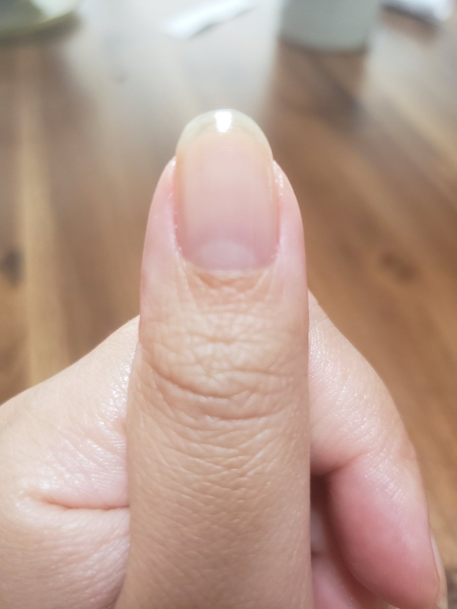 もず 深爪直したい Ywpebeax5bnk0of Twitter