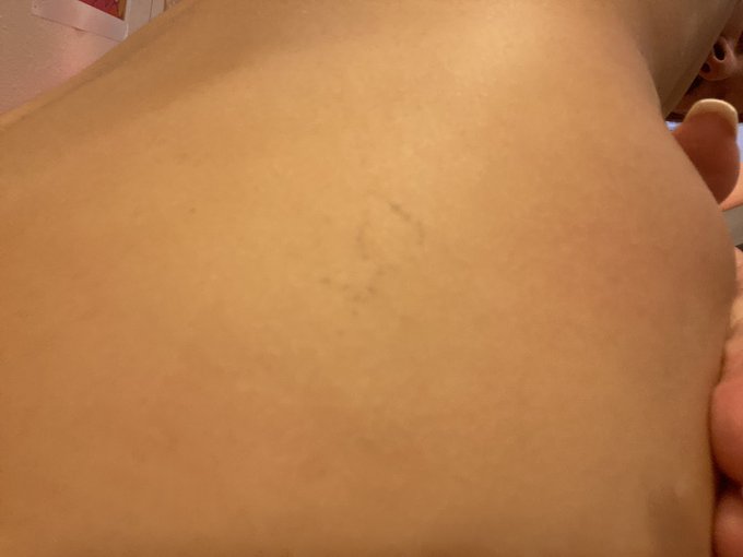 Someone tell me how I only just now realized I have a very faint stick &amp; poke tattoo on my ass that I<a href="/tag/acab"class="tags"><span>#acab</span></a><a href="/tag/blacklivematter"class="tags"><span>#blacklivematter</span></a><a href="/tag/justiceforgeorgeflyod"class="tags"><span>#justiceforgeorgeflyod</span></a>