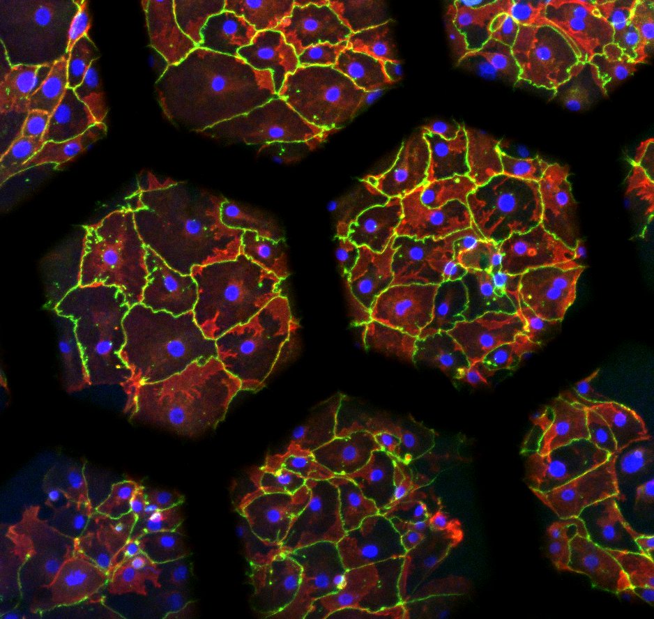 @Swiss3RCC's winning replacement project: Olivier Guenat @unibern #ARTORG & Thomas Geiser #pneumology Department @inselgruppe grow human #lung cells in new generation of #invitro models #OrgansOnChip to study idiopathic #pulmonary #fibrosis & therapy #IPF bit.ly/IPFonChip