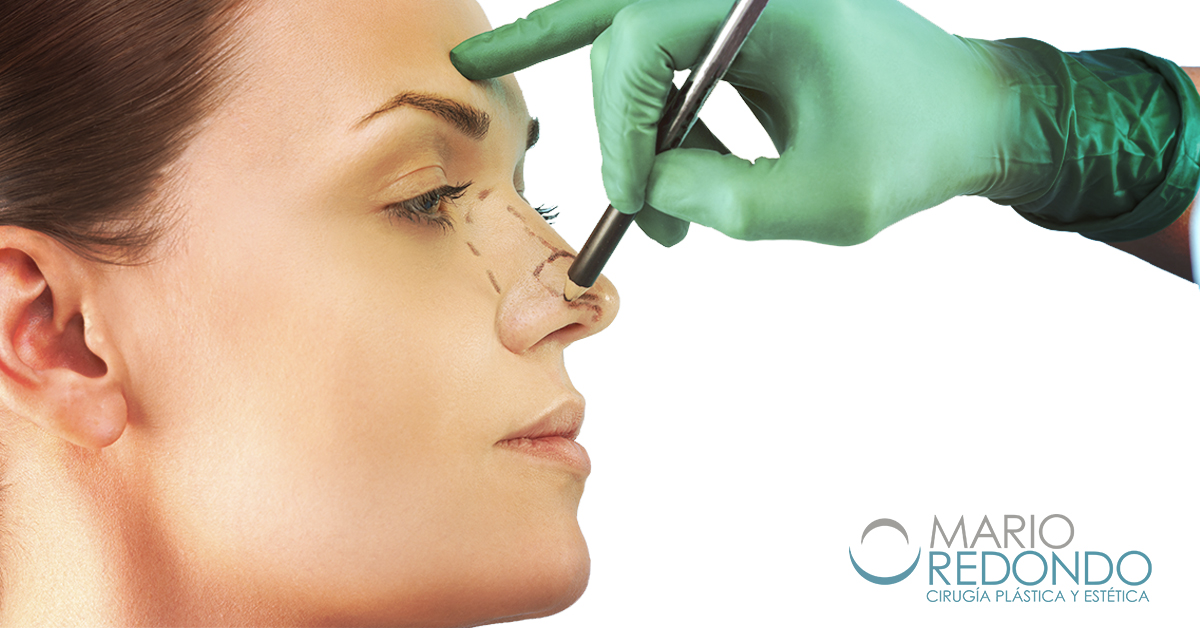 Si has pensado hacerte una rinoplastia por tener una nariz grande, ancha o aguileña, cuenta con el Dr Mario Redondo. Puedes concertar tu cita o pedir información en el teléfono: 954 23 71 97

marioredondo.com/cirugia/cirugi…

#DrMarioRedondo #Surgery #Cirugía #rinoplastia #operacionnariz