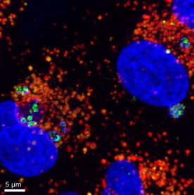 Excited to share our new work on how the intracellular environment affects S. aureus persistence in <a href="/FrontiersIn/">Frontiers</a> Microbiology. frontiersin.org/articles/10.33… Congrats to Nicola Häffner for her first first author paper with <a href="/Julian_R_Baer/">Julian Baer</a> <a href="/heidi_crosby/">Heidi Crosby</a> <a href="/Horswill_Lab/">Horswill Lab</a> and an amazing team!