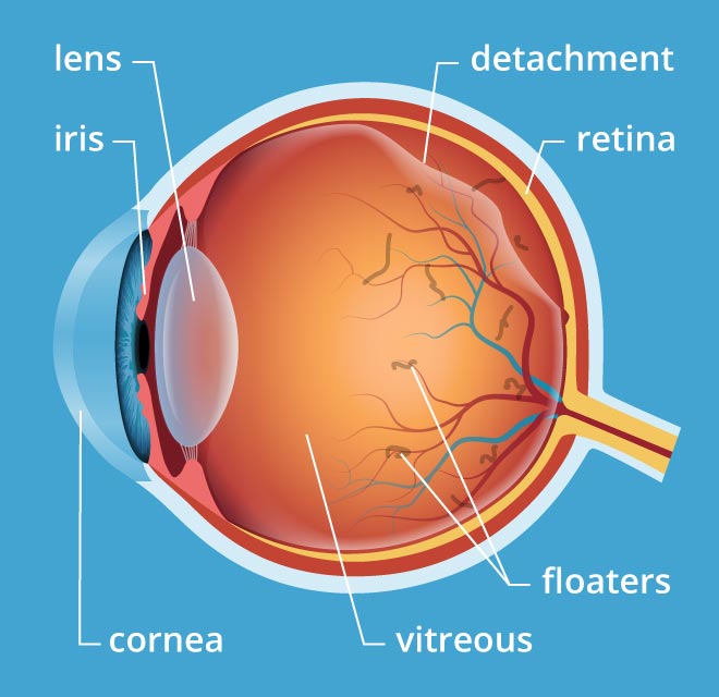 TheEyeGuys's tweet image. Flashes, Floaters, and Vitreous Detachment
What do you need to know? Find out more on our website.
fishbaughfamilyeyecare.com/flashes-floate……/
#fishbaughfamilyeyecare #theyearofperfectvision #eyehealth #learnmore