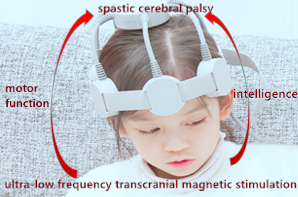 ctnsd_editor's tweet photo. #CTNSD Effects of ultra-low frequency transcranial magnetic stimulation on motor function and intelligence of children with spastic cerebral palsy: study protocol for a randomized parallel-cohort controlled trial
#cerebralpalsy #magneticstimulation

https://t.co/foVpEexDvt https://t.co/A5p8Mbk81r