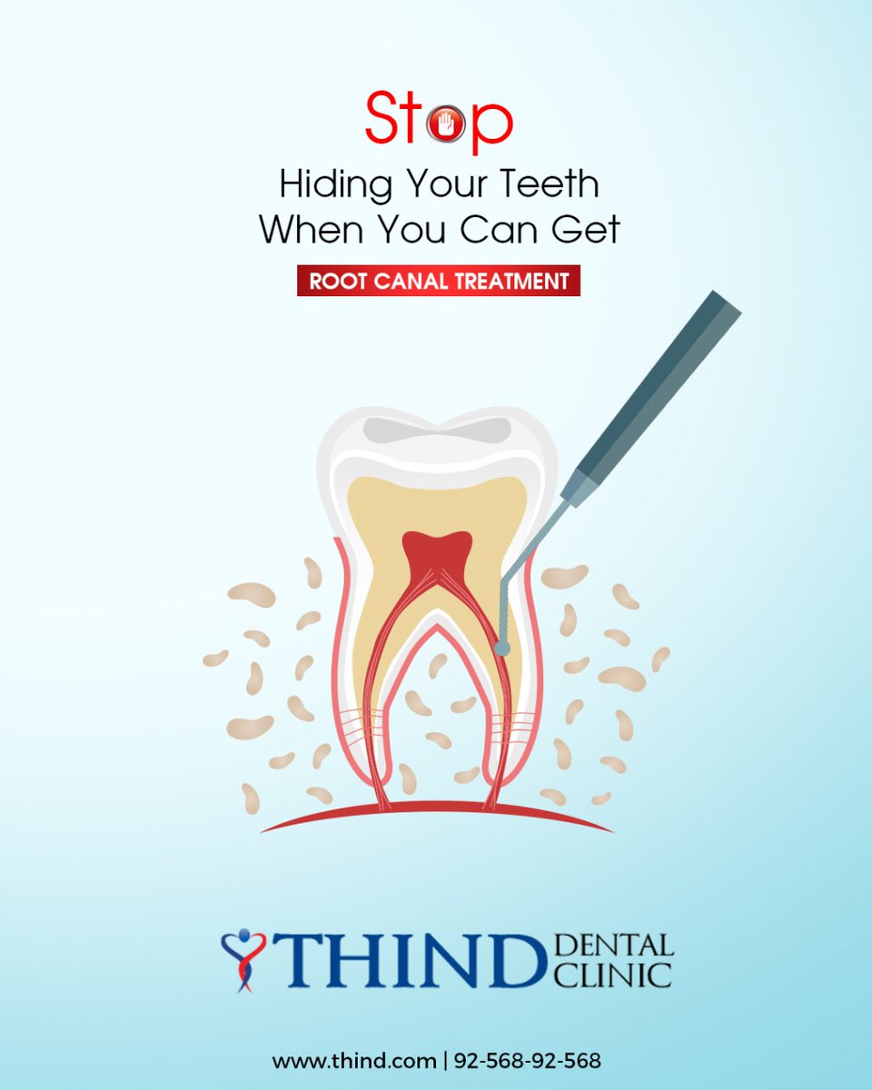 Painless and Single Sitting Root Canal Treatment Is Available At Thind Dental Clinic.😊

~Safe, Simple And Cost Effective~

Call For Appointment - 92568-92568

#thinddentalclinic #dentalcheckup #beautifulsmile #healthyteeth #rootcanaltreatment #painlesstreatment
