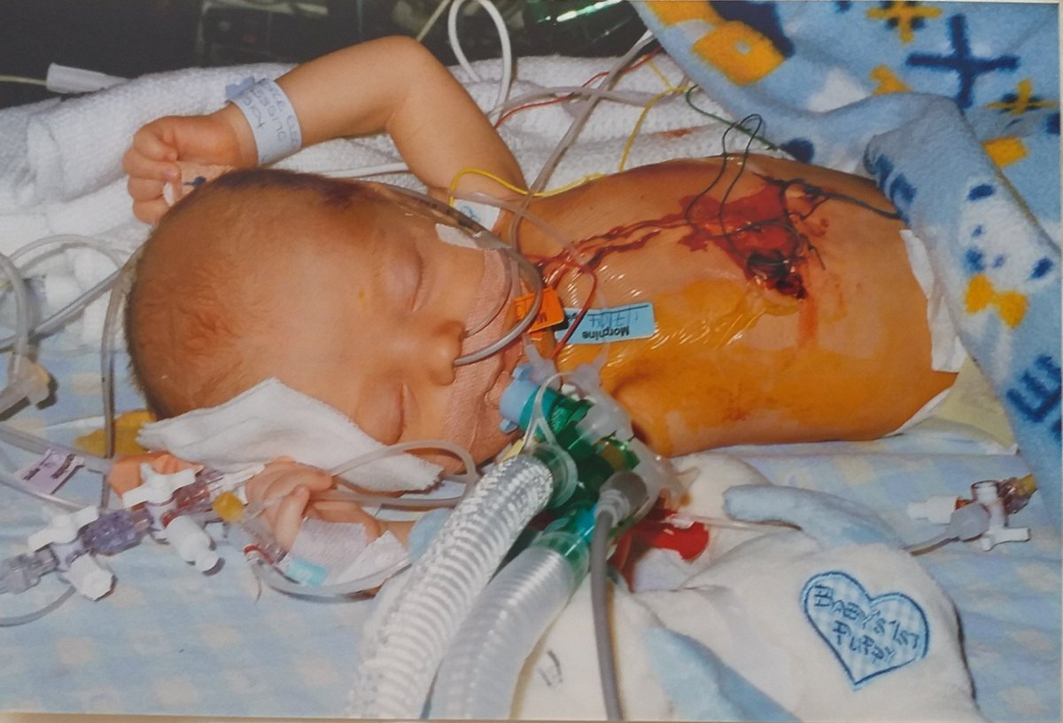 MoochelleCows's tweet photo. Today it is 16 years since the amazing Glenfield hospital saved my son George's life. #TAPVD #NHS #NHSheroes #Leicester Thank you doesn't seem enough, always grateful💙 https://t.co/VthQ4Svlo8