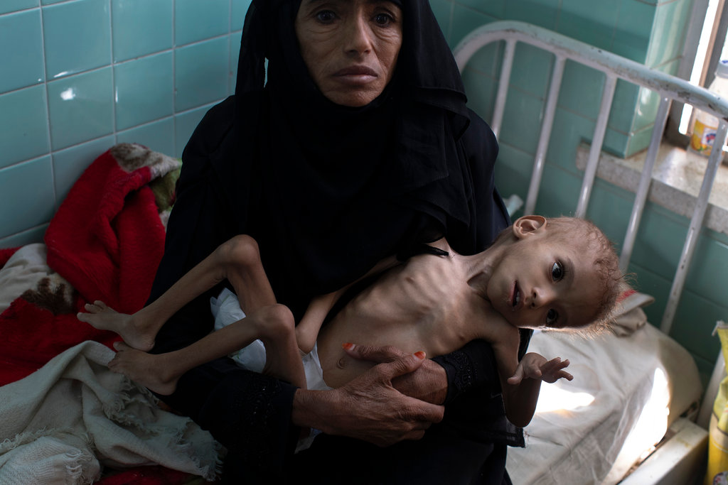  #Yemen"Two million children under the age of five are malnourished, 325,000 of which have severe, acute malnutrition. By the end of 2020, there will be 2.4 million malnourished children under the age of five" in Yemen, directly cause by the US Saudi Coalition blocking food!