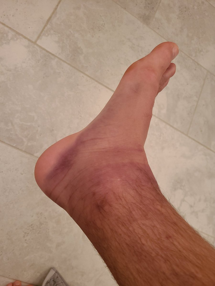 DustinPoirier's tweet image. Kankle