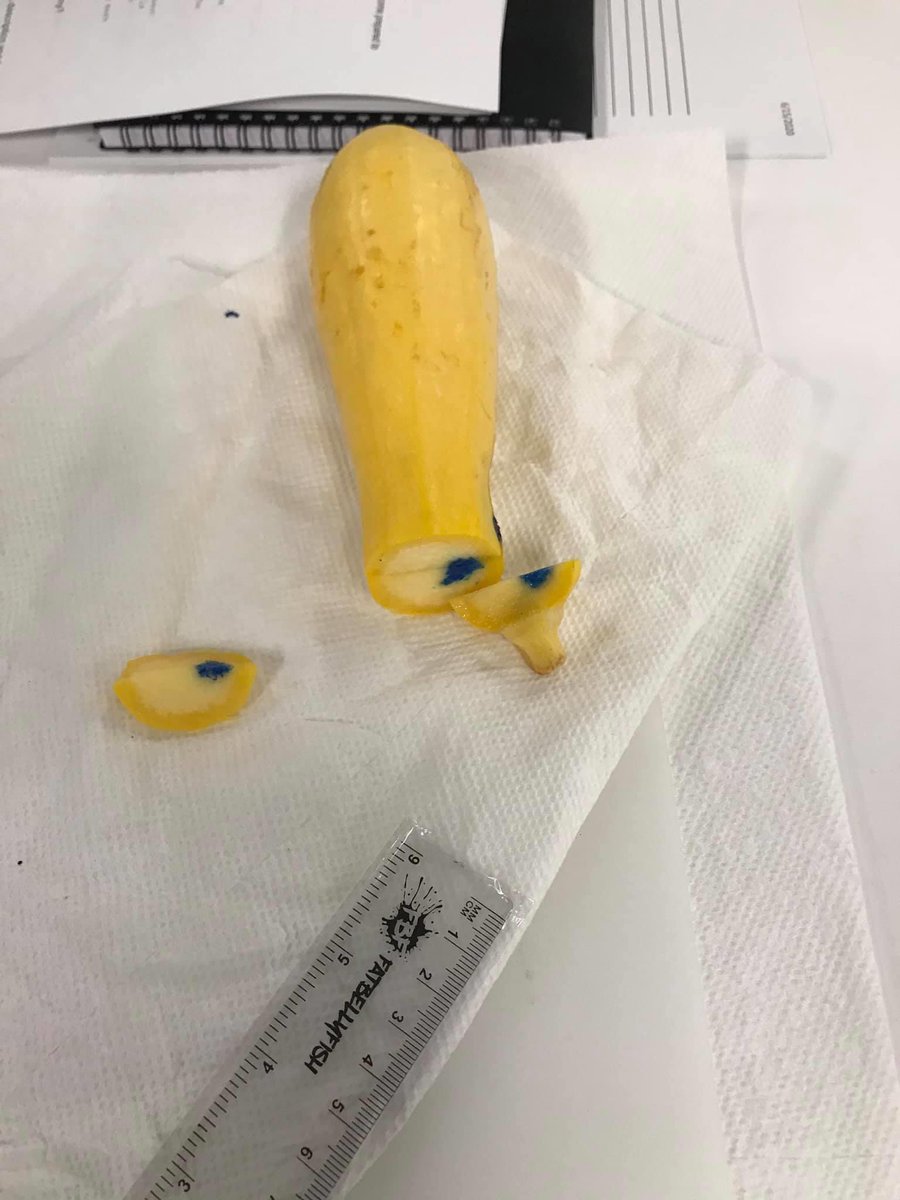ApekshaNas's tweet photo. @smlungpathguy @CCFPathRes @CLEClinicLabs @ScottBikeethan @erikacytogal @evemariecrane @Williamson_SR @GaryProcop @UTHealthSA_Path @LGreebon I like this for orientation. Practicing cutting fruits/ veggies before boot camp seems like a nice way to reduce stress of ruining the very first specimen. Additional images from @smlungpathguy FB page. Thank you for sharing Dr. Mukhopadhyay! https://t.co/NlHh7KeIqr