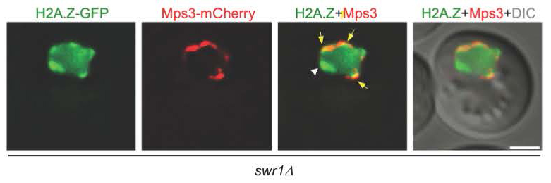 SueJaspersen's tweet photo. Sara was a visiting scientist in the lab a year ago.  Excited to see her project come together into such an important story on the role of H2A.Z in meiotic chromosome movement. https://t.co/sHWdSIV6Xw https://t.co/KykA3aadEZ