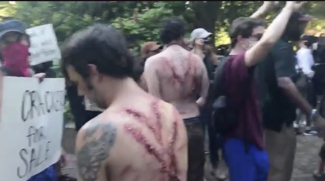 This isn’t about helping black people, it’s about growing the government and centralizing power. It’s about removing autonomy from the poor, and eventually the middle class.And they don’t care about anything but looking important and benevolent in the process.End