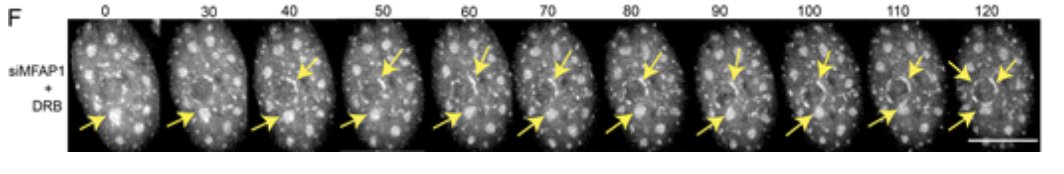 Revisiting nuclear speckle proteomics with TSA-MS-Ratio: ~70% of top 100 proteins were previously shown by microscopy to be concentrated in speckles.  Special focus on MFAP1, whose levels modulate speckle size and stability. doi.org/10.1083/jcb.20…