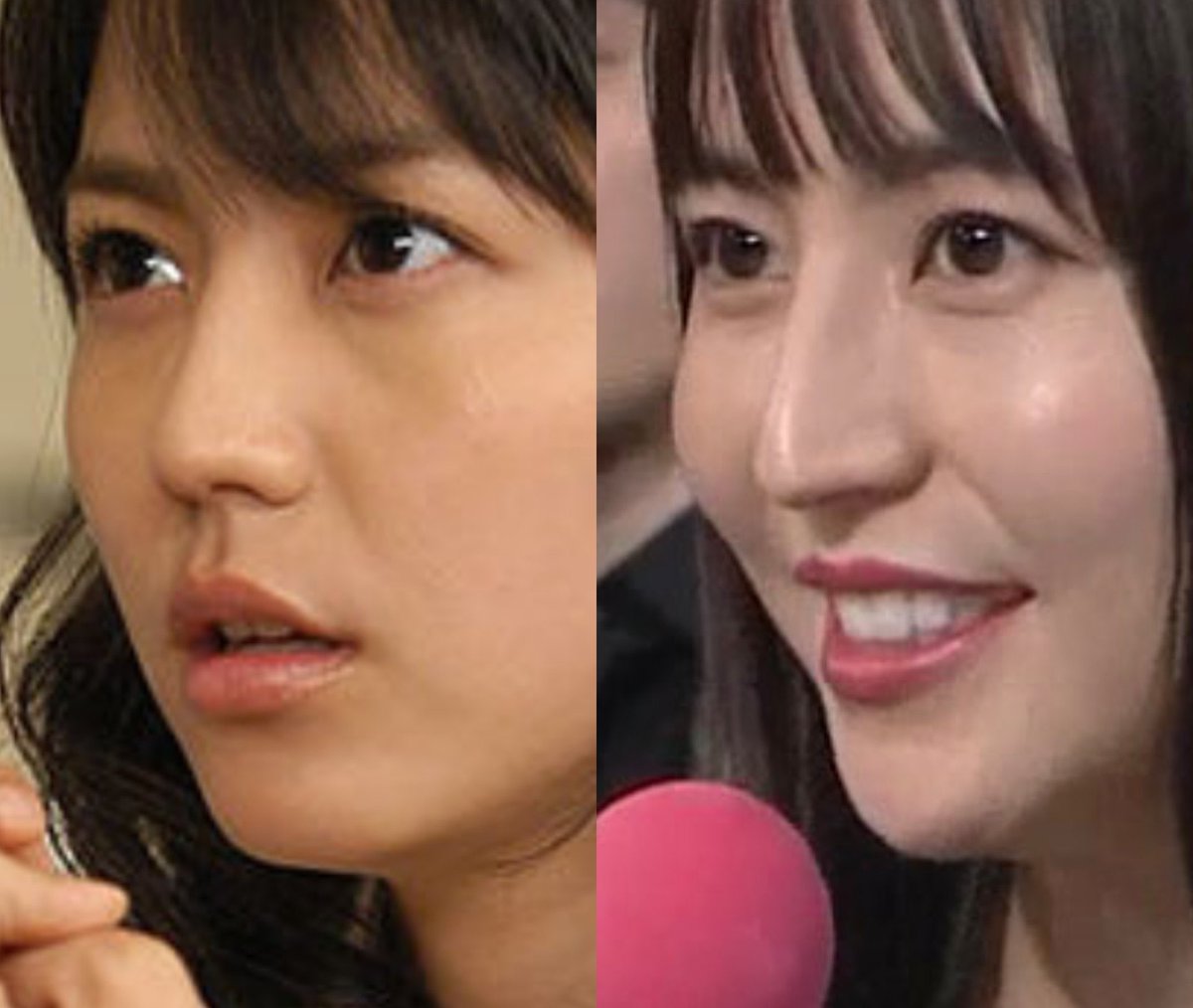 雪花 長澤まさみ 鼻の先いじったなぁやっぱり 雪花 長澤まさみ 鼻の先いじったなぁやっぱり