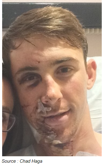 Le 24 janvier 2016, en Espagne, une partie de l’équipe Giant Alpecin est violemment percutée à l'entraînement. Chad Haga en sort fortement blessé, une cicatrice et 97 points de suture, qui parcourent son corps, du nez jusqu’au sternum.