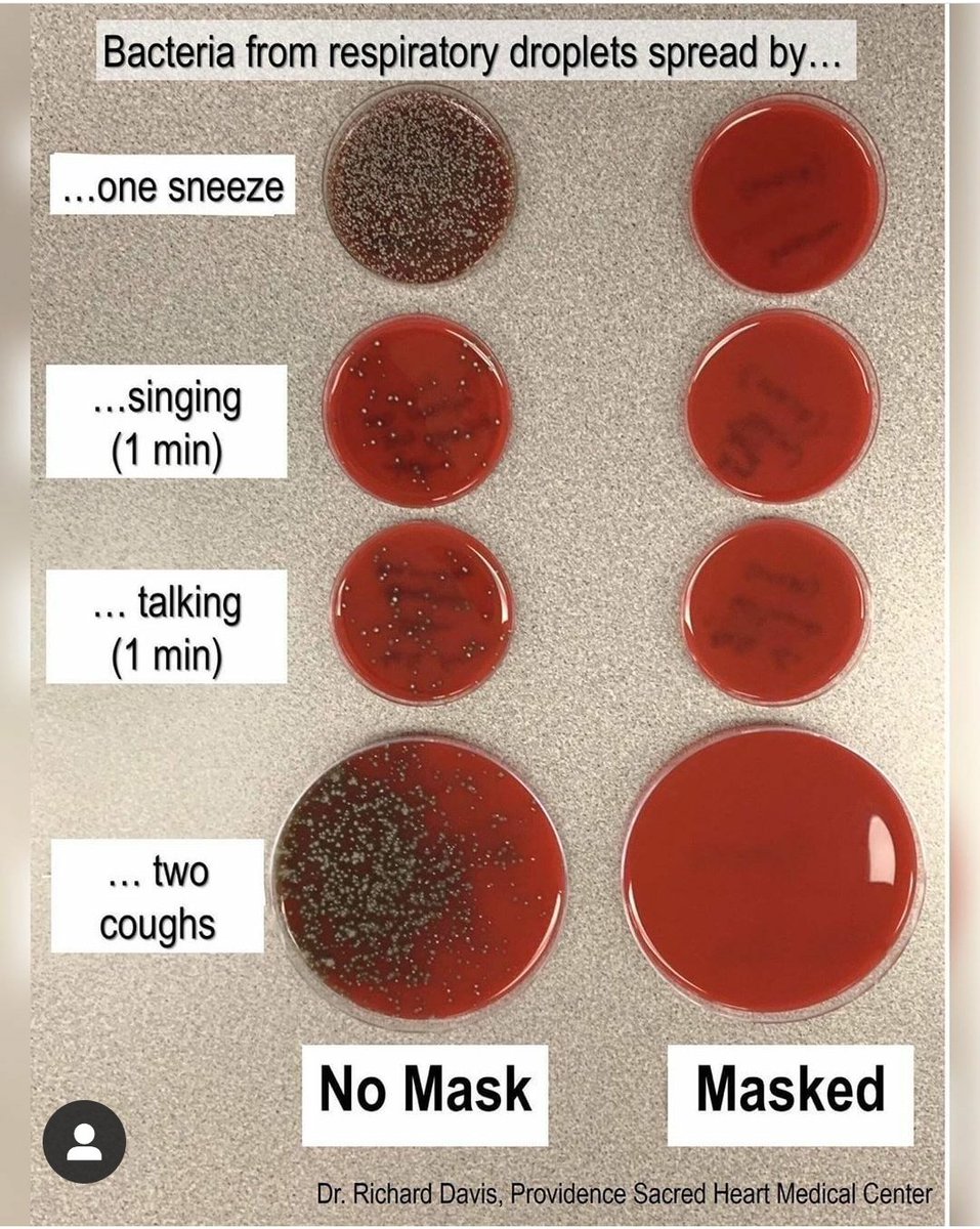 DBlack_Mountain's tweet photo. Well Rand Paul?

Science Proves The Effectiveness Of A Mask.

2023 Can't Come Soon
Enough. https://t.co/ZuY8BU05G4
