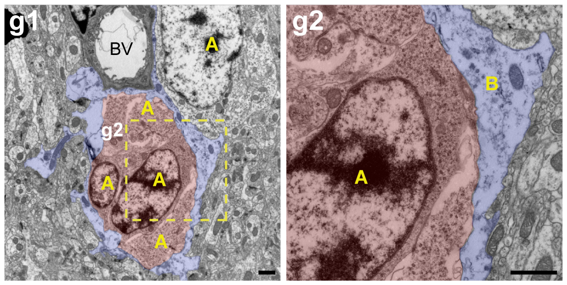 4. We verified with several markers that those cells were indeed neuroblasts, not other cell types like OPCs or microglia expressing DCX. We also did electron microscopy together with Vicente Herranz  @vherranz and JM García-Verdugo. Beautiful images!  @UV_EG 