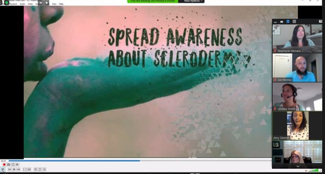 CorbusPharma's tweet image. Thank you to Amy (@skindeep217) and Joi for visiting us virtually on #WorldSclerodermaDay, sharing your experiences with #scleroderma, and inspiring our team. #SclerodermaAware
