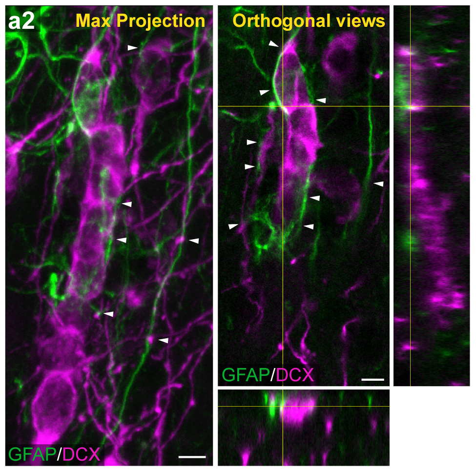 7. And it turns out that neuroblasts in the NAc follow not only radial glia-like fibers, but also blood vessels!