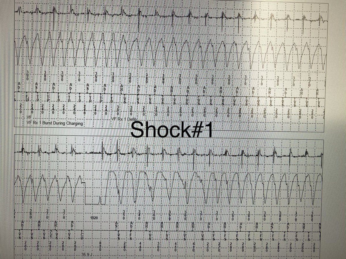Imdad Ahmed,MD tweet media