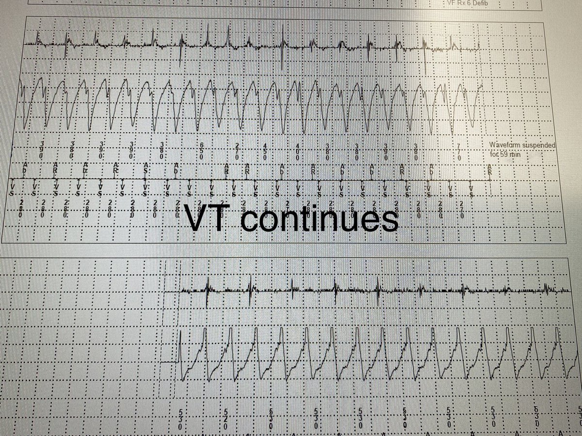 Imdad Ahmed,MD tweet media