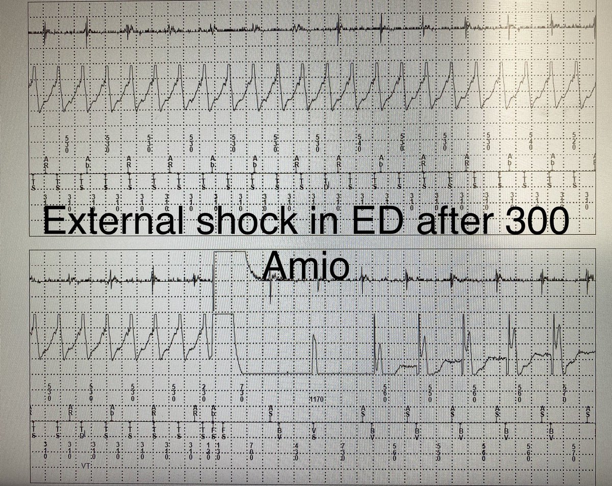 Imdad Ahmed,MD tweet media