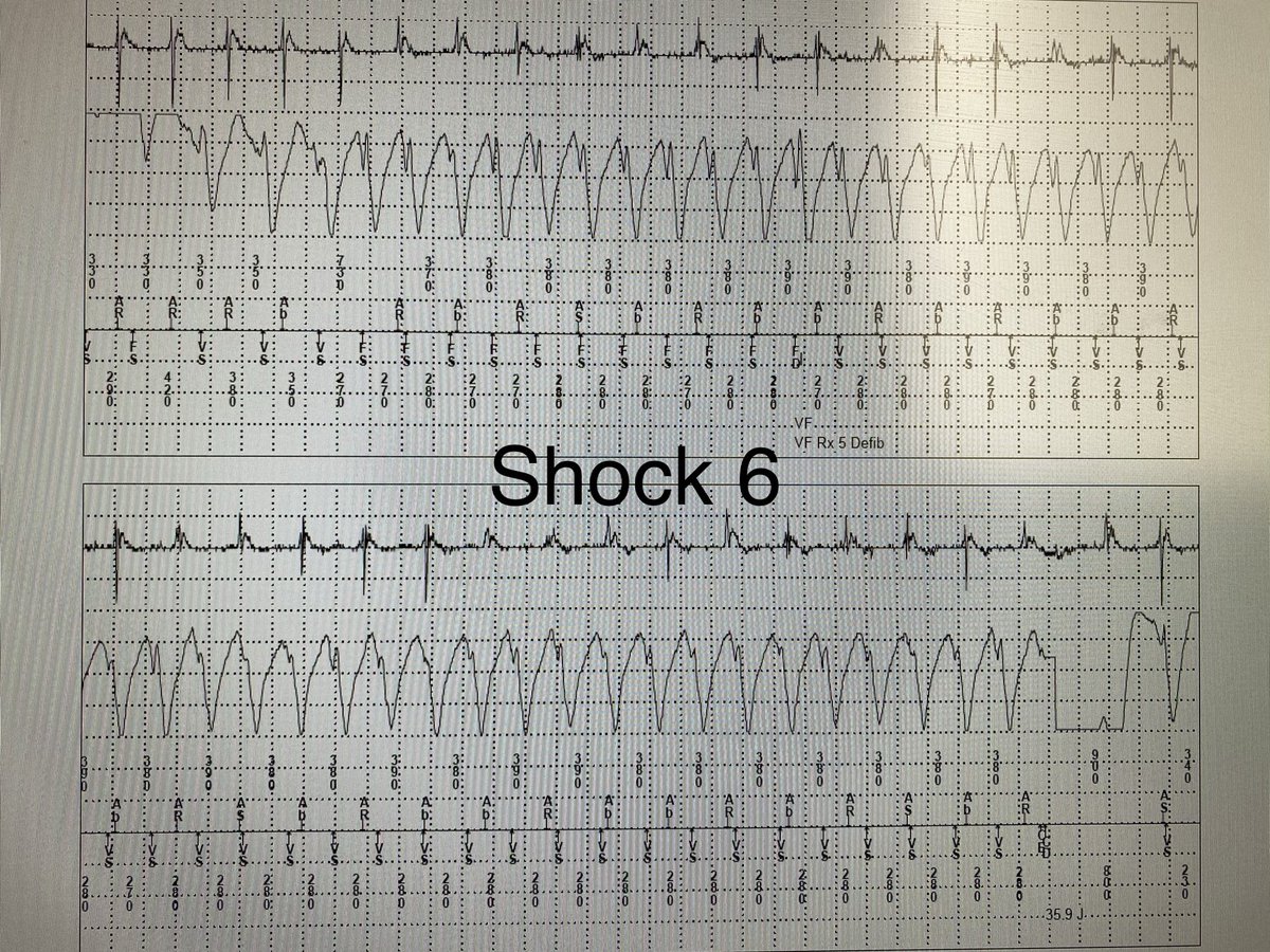 Imdad Ahmed,MD tweet media
