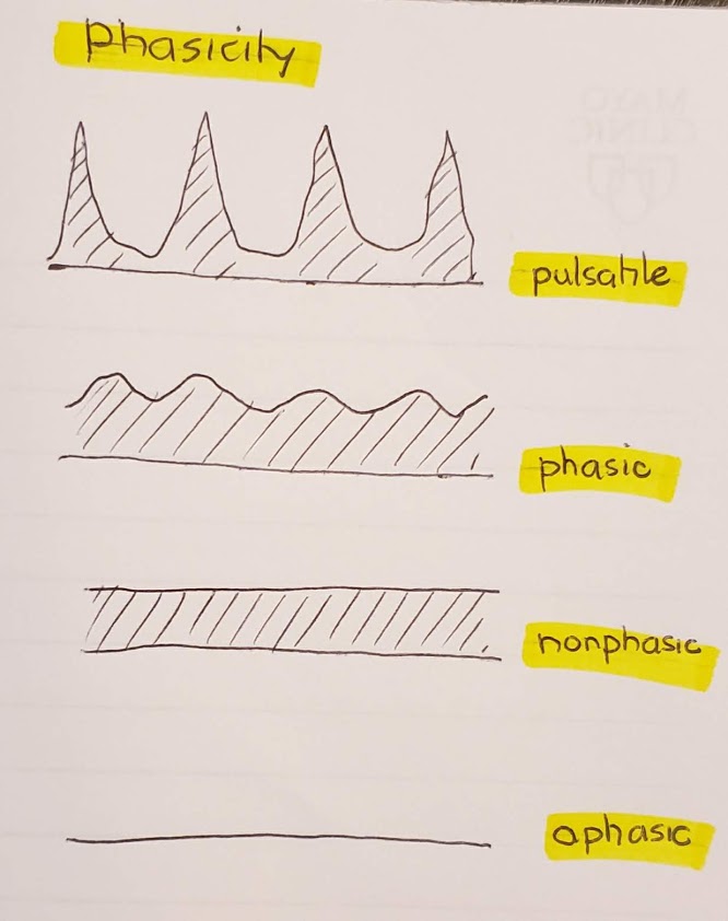 (5/13)*Phasicity* simply indicates degree of fluctuation of the waveform. Aphasic: no flow at all!Non-phasic: flow but no fluctuationsPhasic: undulating or fluctuating waveform Pulsatile: undulating or fluctuating waveform but to a higher higher degree of phasic.