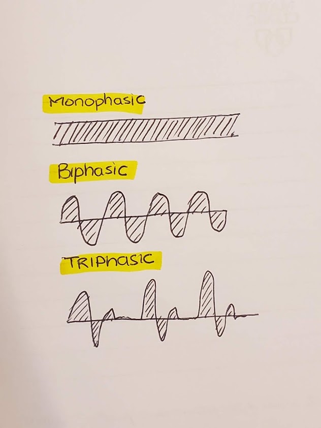 (6/13)*Phase quantification* this is where things get interesting and you will see considerable variability. Simply, a phase occurs when your waveform crosses the baseline. So the phasic and pulsatile flow shown in the above tweet are MONOPHASIC! Bi- and tri-phasic