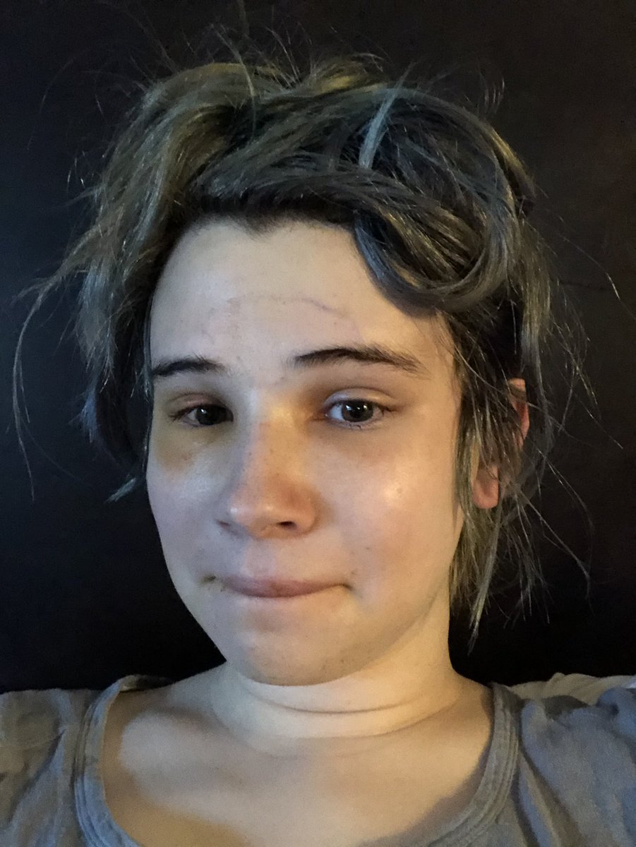 SomeBWord's tweet photo. with the swelling going down and the bandages off temporarily I literally just keep looking at my face and sobbing https://t.co/yHwU6LzioU