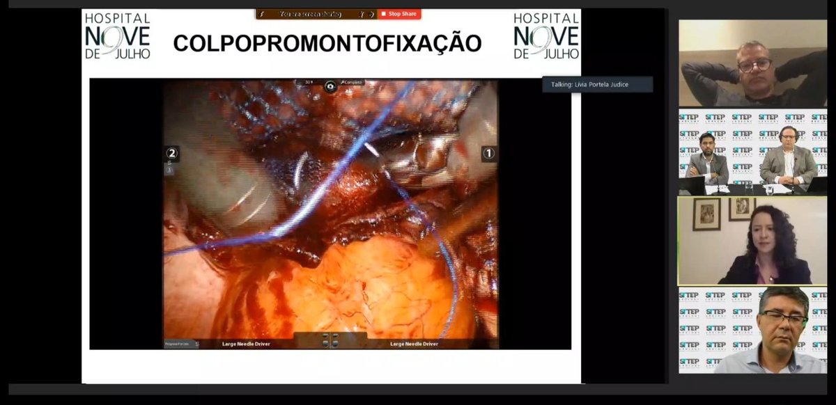 aurusdm's tweet image. Amazing discussion with all the tips and tricks of MI promontofixation.#sttepurology @sbuoficial @docmeetings @Uroweb @CAU_URO