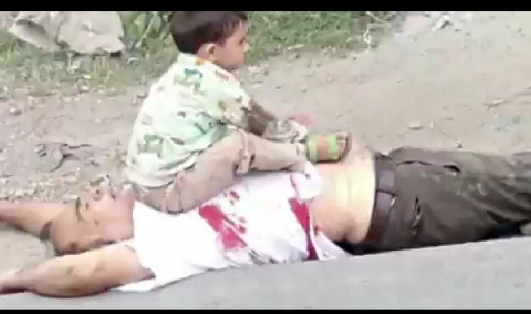 amarrjeetsingh's tweet photo. Dear india 
This child will not grow normal! https://t.co/BR33ROYVn3