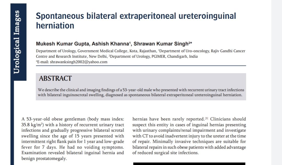 indianjurol.com/article.asp?is…

Our report on a rare clinical entity with interesting images : Spontaneous bilateral uretero- inguinal herniation .