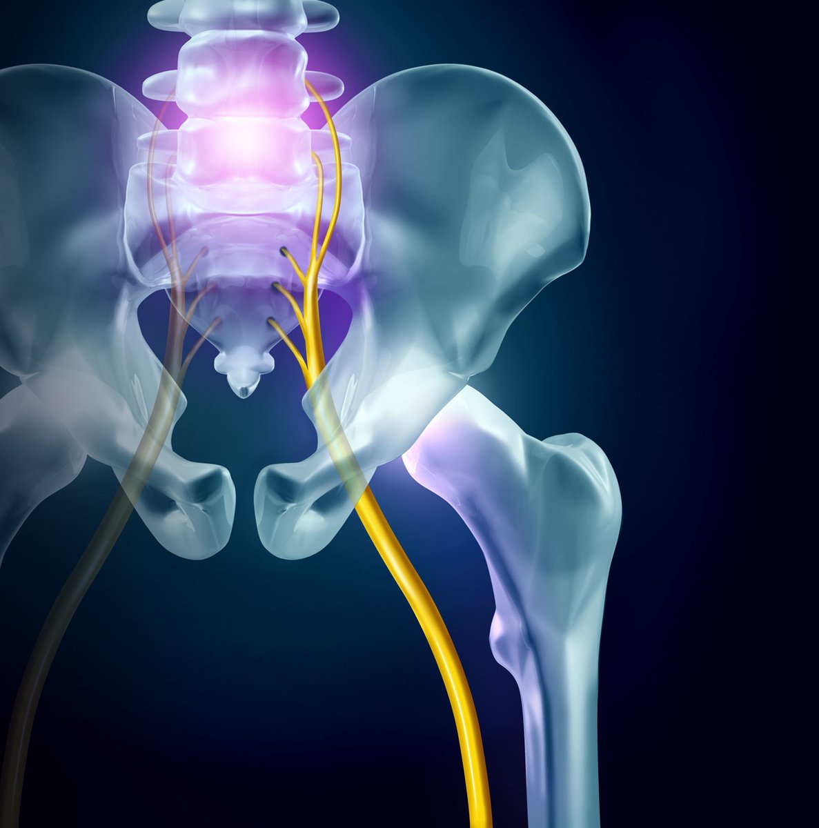 The Lancet Rheumatology (@thelancetrheum) on Twitter photo <a href="/NIHRresearch/">National Institute for Health and Care Research</a> <a href="/Keele_CTU/">Keele Clinical Trials Unit</a> @Keele_PCSC "Improving the management of sciatica"
Linked comment by <a href="/bartkoes/">bart koes</a> <a href="/erasmusmcintl/">Erasmus MC Intl</a> thelancet.com/journals/lanrh… #LancetRheumatology <a href="/NIHRresearch/">National Institute for Health and Care Research</a> <a href="/Keele_CTU/">Keele Clinical Trials Unit</a> @Keele_PCSC "Improving the management of sciatica"
Linked comment by <a href="/bartkoes/">bart koes</a> <a href="/erasmusmcintl/">Erasmus MC Intl</a> thelancet.com/journals/lanrh… #LancetRheumatology