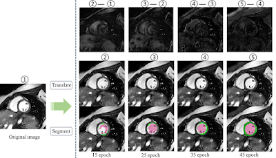 Radiology_AI's tweet photo. MRI Manufacturer Shift and Adaptation https://t.co/xubwpQWM3O @DrQtao #adaptableAI #AI #ML https://t.co/nS8LBq32Cw