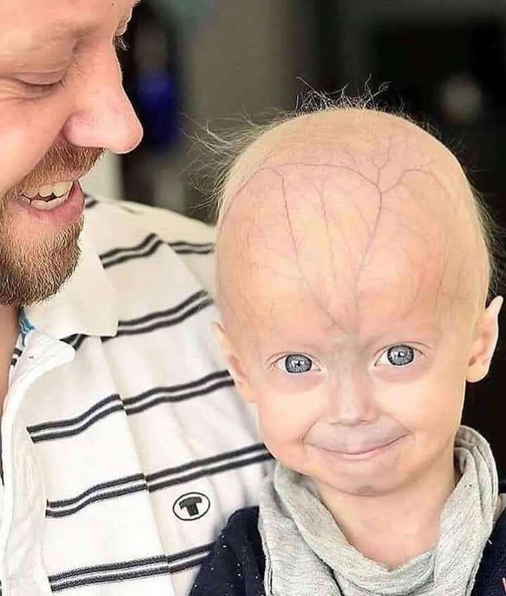 DWMOfficial's tweet image. This cute kid had cancer. Recently he was tested positive with Coronavirus. Still his diseases cannot beat his smile. ♥️

#PrayForHim