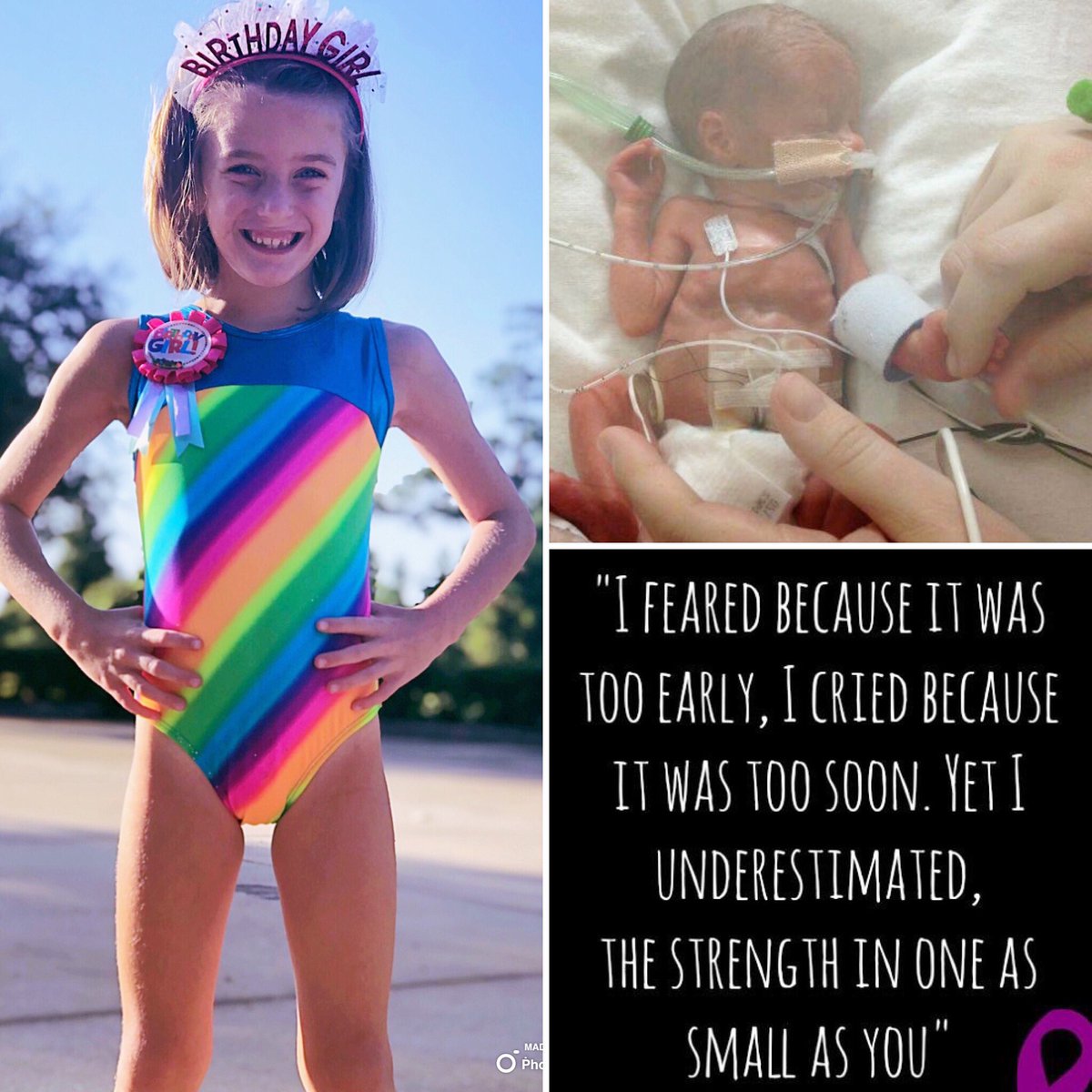 From glass, wires, and machines in the NICU to beans, cartwheels, and bridges in Gymnastics; this miracle continues to defy all odds.   Today she is proudly rocking turning 7. Happy Birthday, baby girl! 💗#nicustrong #macropreemie #hellpssurvivors #believe #ourjourney #miracles